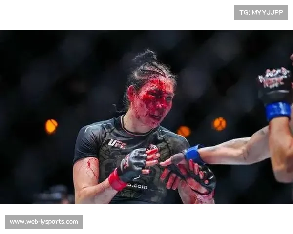 因阿尔-塞尔瓦迪退赛引发热议，UFC选手合约与权益保障制度亟待完善